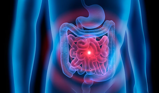 Picture of a colon